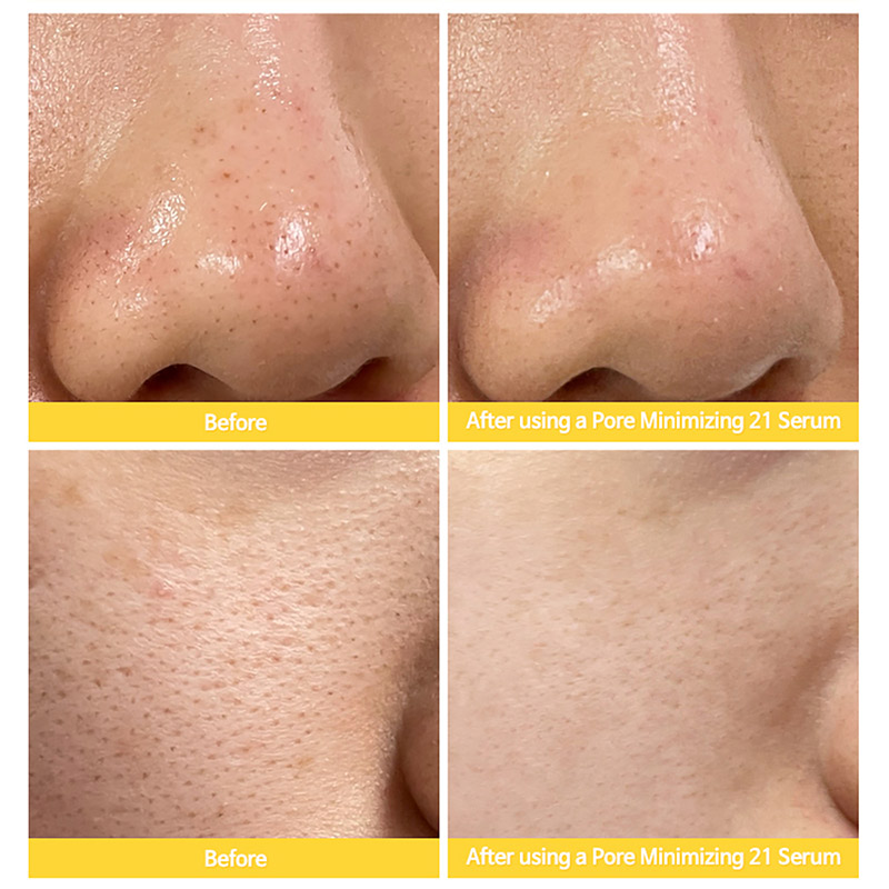 syvorotka_dlja_suzhenija_por_tiam_pore_minimizing_serum3-800×800